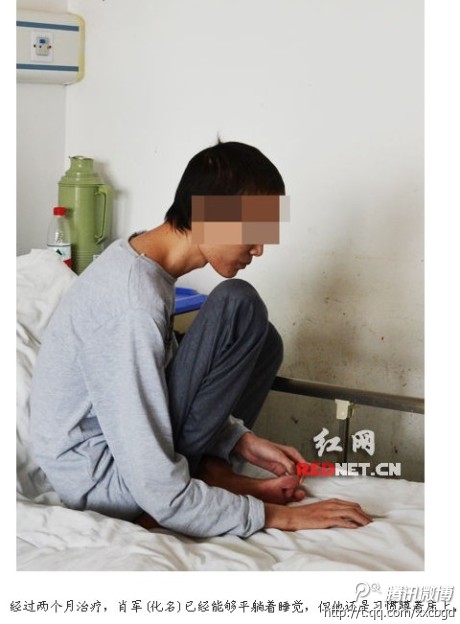 湖南90后網(wǎng)癮男患肺結(jié)核只能蹲著睡