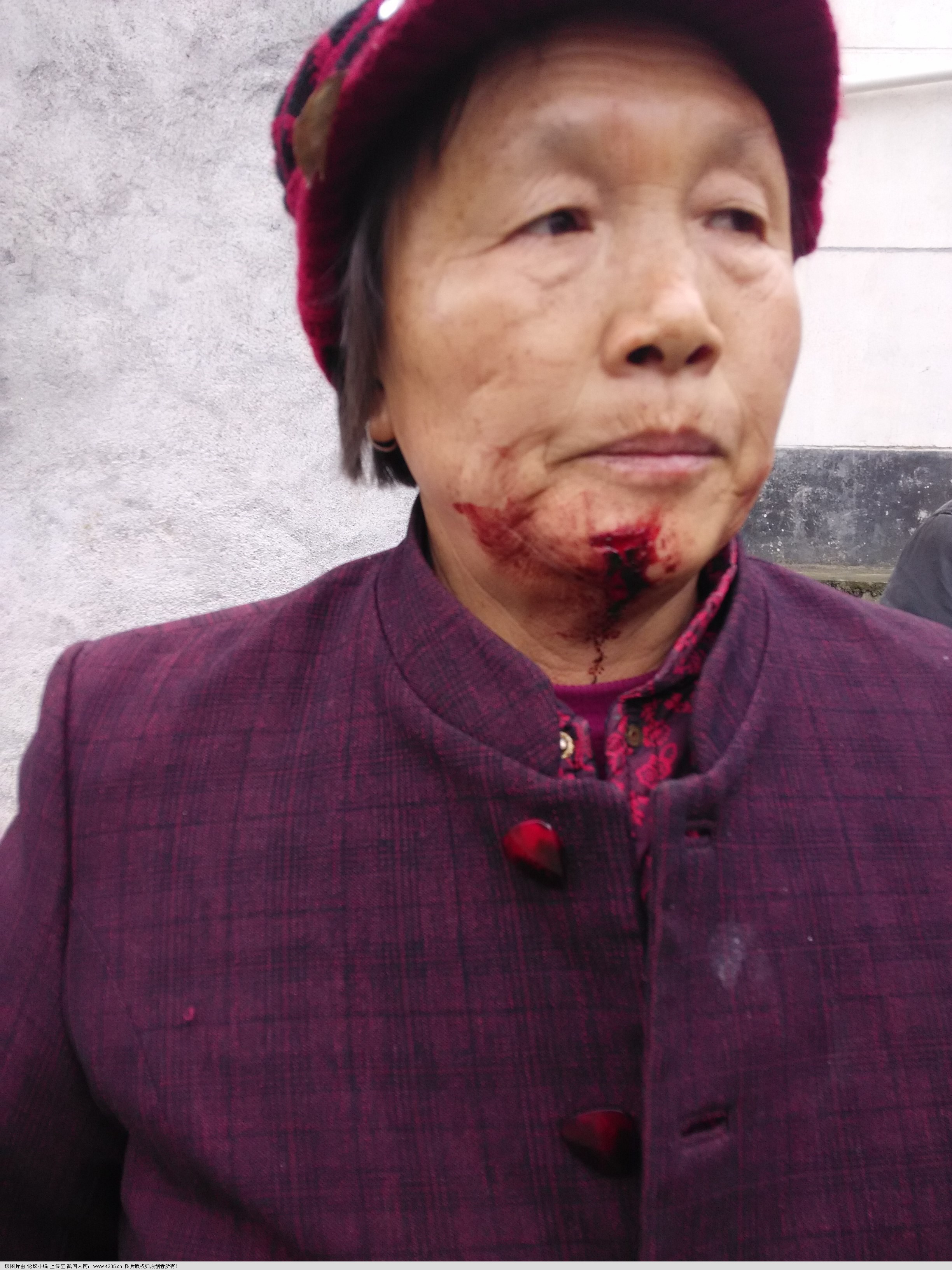 是眼疾，还是心疾？