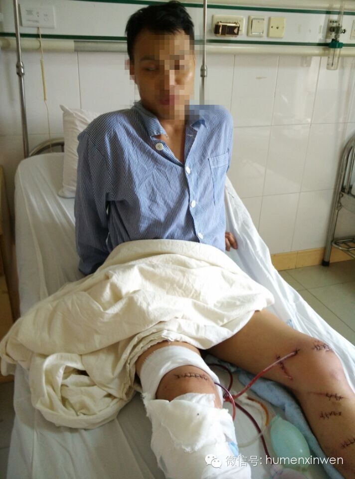 恐怖：武岡老鄉(xiāng)在虎門被五名男子持刀砍殺