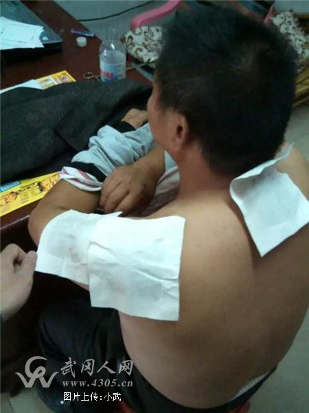 武冈的国家专利“脏腑筋骨疼痛外用膏”