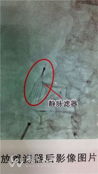 QQ圖片20160808094612.jpg