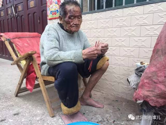 武岡老人無兒無女孤寡無助，神志不清跑出家門找回后滿頭是血.....