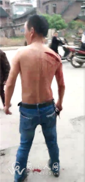 血流滿地，好嚇人！武岡這人啥情況？