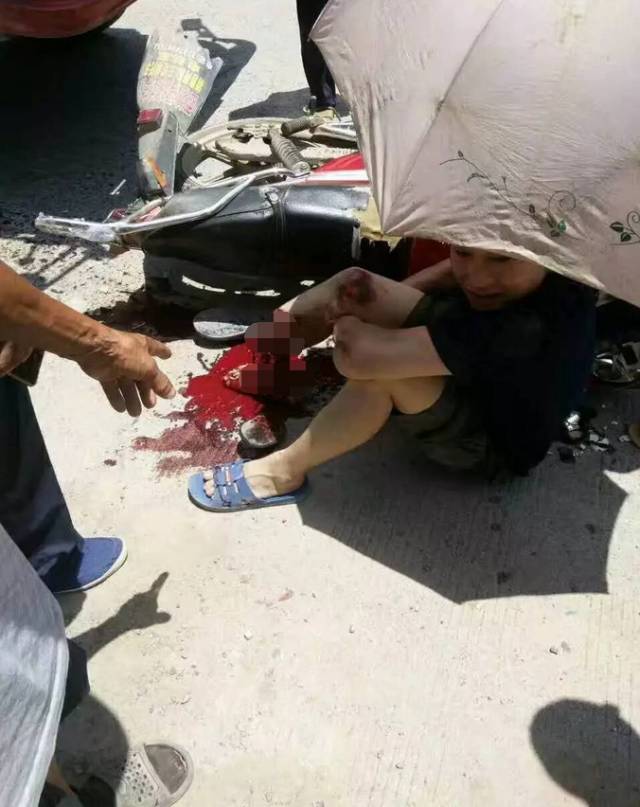 武岡荊竹發(fā)生一起車(chē)禍，摩托車(chē)司機(jī)小腿脫離，現(xiàn)場(chǎng)慘不忍睹！