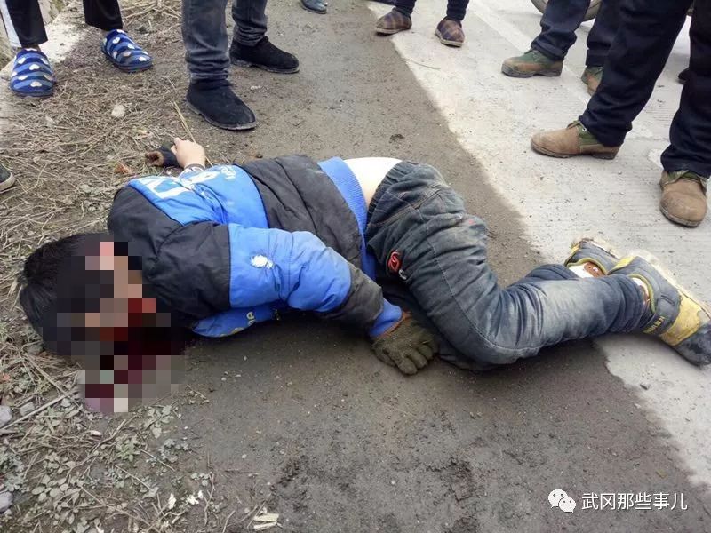 武岡9歲小男孩被撞,父母均在外務(wù)工,醫(yī)院全力搶救