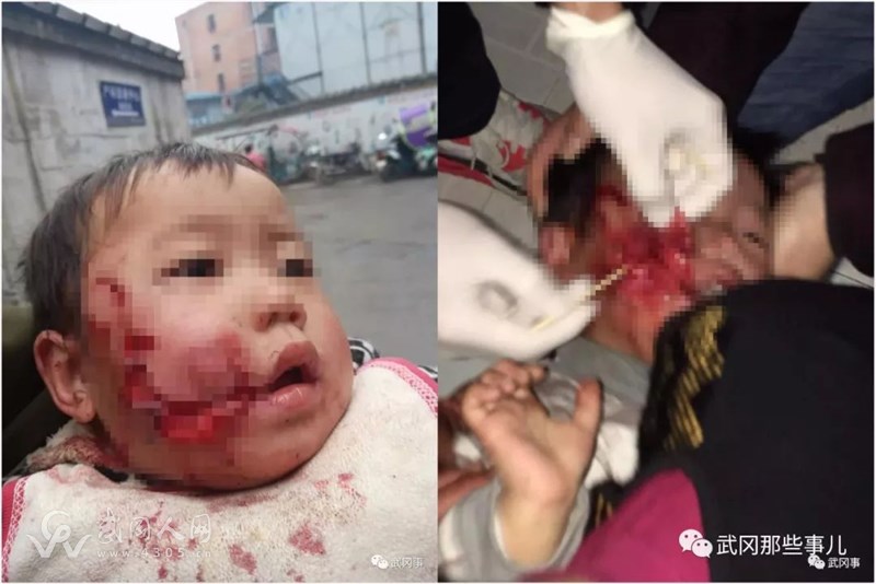 武岡一條瘋狗鬧市咬人,被打死!