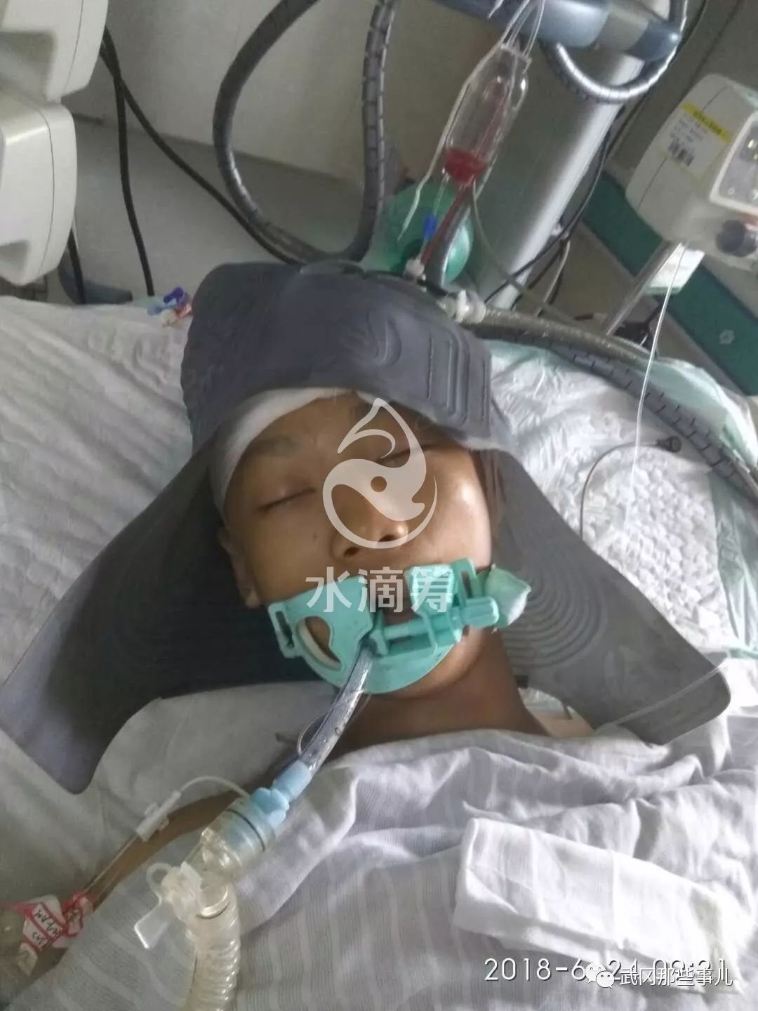 武岡16歲花季少年被下病危通知