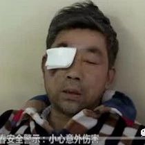 男子春節(jié)燃放煙花，導致右眼失明！