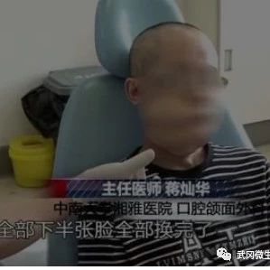 湖南小伙每天恰5包檳榔, 10年后…