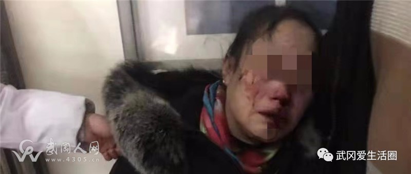 家暴！武岡一女子被丈夫打得慘不忍睹...