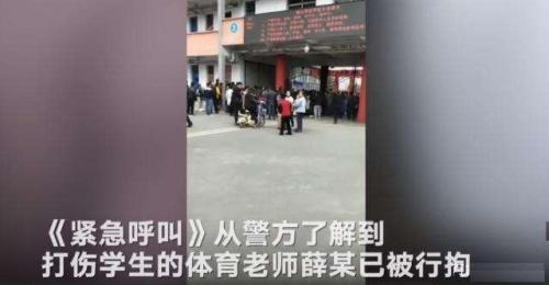 小学生被踢后身亡：局部感染导致全身的感染，最终诱发死亡